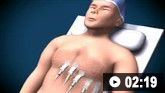 How to perform an ECG: animated demonstration